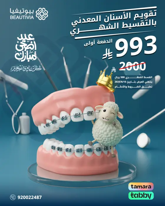 تصميم عروض سوشيال ميديا لعيادات بيوتيفيا - عرض تقويم الأسنان